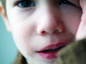 Identifier la dysphasie (Trouble développemental du langage)