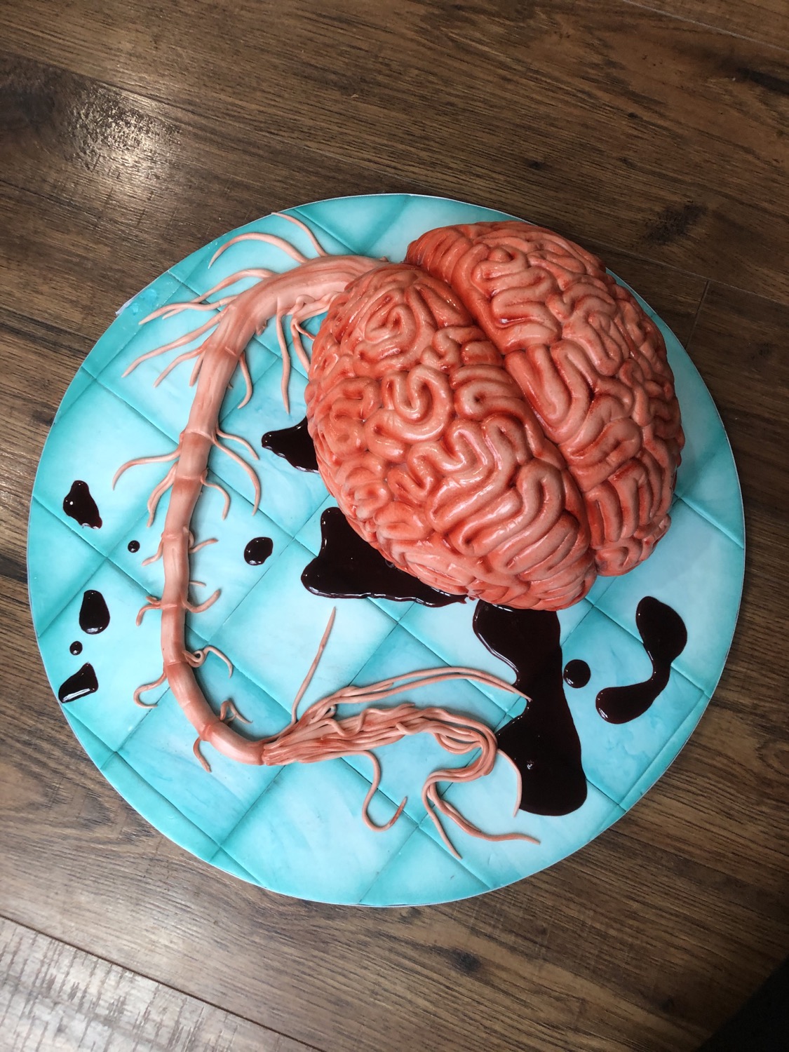 Brain With Spinal Cord