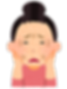 皮脂欠乏症の女性