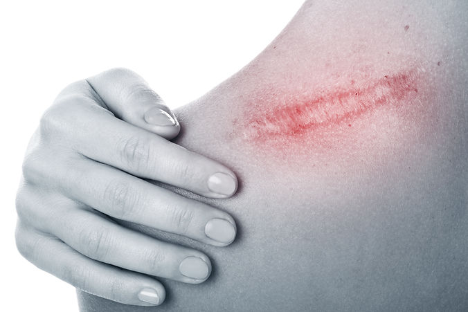 Diplomkrankenschwester Skincare Hautbildanalyse Betreuung Unterstützung Pflegedienst Mobiler Pflegedienst Herzogsdorf Urfahr Umgebung Verena Lanzerstorfer Manuel Hartl Picbe Oberösterreich Mühlviertel Hautberatung Haemo Laser Low Level Lasertherapie Gesundheitsförderung Demenz Sturzprophylaxe Pflege Zuhause