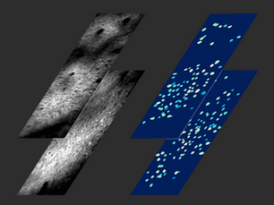 2-kHz Brain Imaging and 500-Micron Depth: The Microscopy Breakthrough Redefining Neural Circuit Research