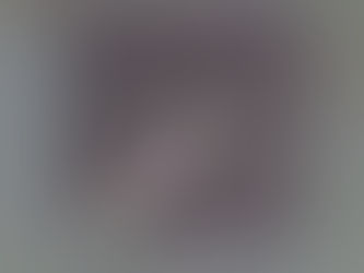 From Brain Organoids to Paralysis Therapy, Micro-Implants Are Opening New Frontiers