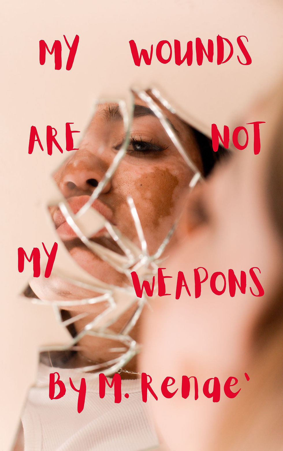 My Wounds Are Not My Weapons
