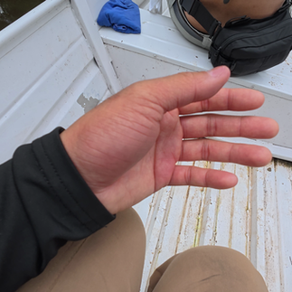 ser andy's hand after bullet ant ritual