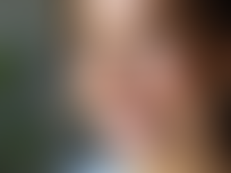 Discover Safe Cosmetic Enhancements with Nilay Ucer