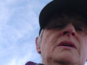 Mouth Breathing & Sleep Apnea