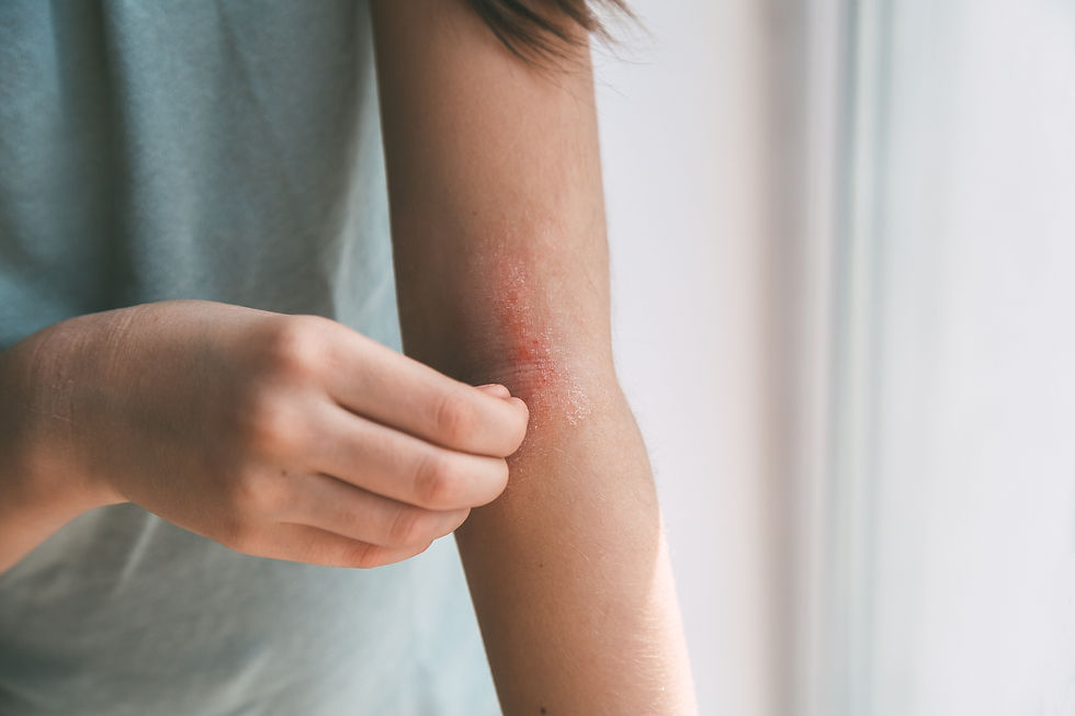Winter Skin Wellbeing | Nourish from the Inside Out