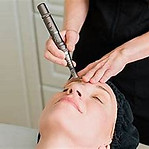 RevitaPen infusion facial for acne and aging skin at SWAN Skin Wellbeing and Nutrition Clinic Kumeu