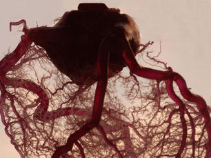 Supermarket trolleys uncover hidden heart conditions