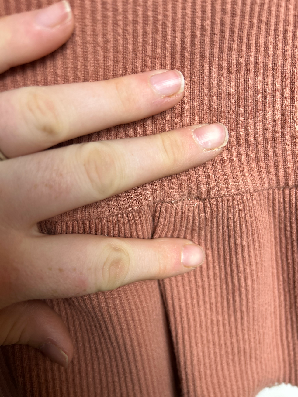 Thumbnail: feral & free (Small Shop)Tank