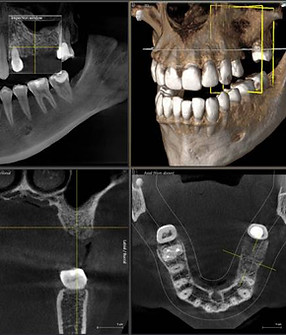 img-image-x-ray-orthophos-sl-3d-8cm.jpeg