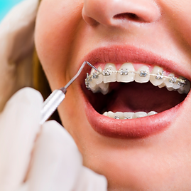 Untitled design (4).png