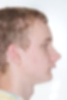 surgical-orthodontics-kingston-25.jpg