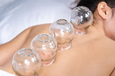 Cupping