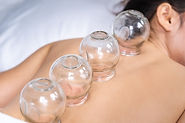 Cupping therapy to relieve pain and muscle cramps