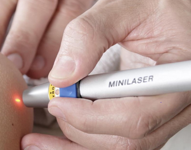 Laser Acupuncture