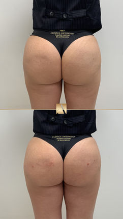 Vista posterior do corpo com enquadramento clínico — Clínica Antonioli, Vila Mariana