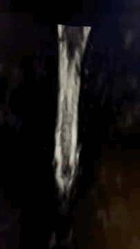Mielorressonância magnética
