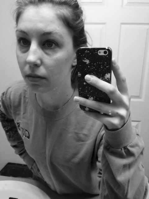 Dark Eye Circles, GAD1, genetc testing, Genomix Testing