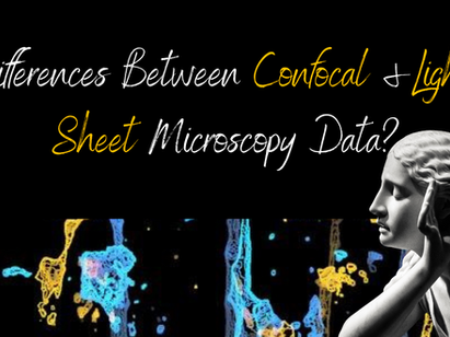 #012 What are Some Differences Between Confocal and Light-Sheet Microscopy Data? Image Analysis Insights