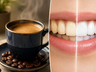 Tomar aquele cafezinho atrapalha seu clareamento?
