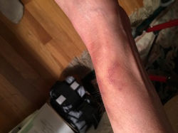 More damage