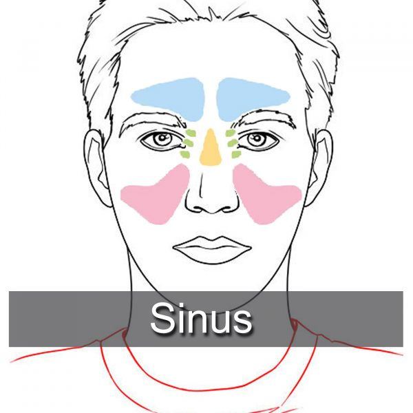 Sinus