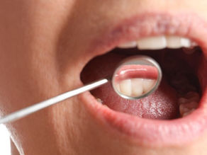 How You Can Prevent Oral Cancer with an El Paso Dentist