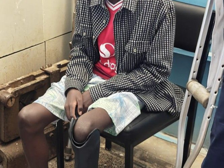 Celebrating Innovation: A Triumph in Prosthetics by Our Alumni