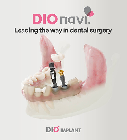 implant