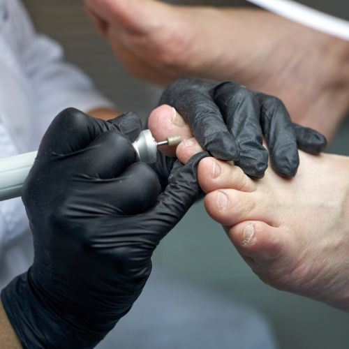 The Beauty of the Dry Pedicure