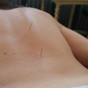 On Point...Discover the Benefits of Dry Needling with Tara