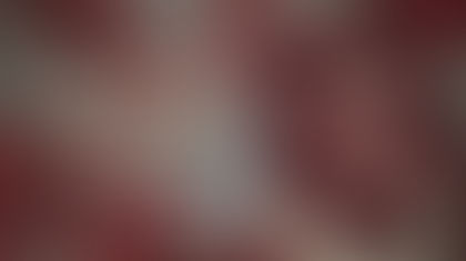 The Treatment Has Released “Bite Back”!