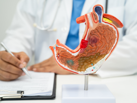 Anatomisches Modell eines menschlichen Magens vor einem Arzt mit Klemmbrett – symbolisch für die medizinische Beratung zur Magenverkleinerung in der Türkei bei Rezena Care.