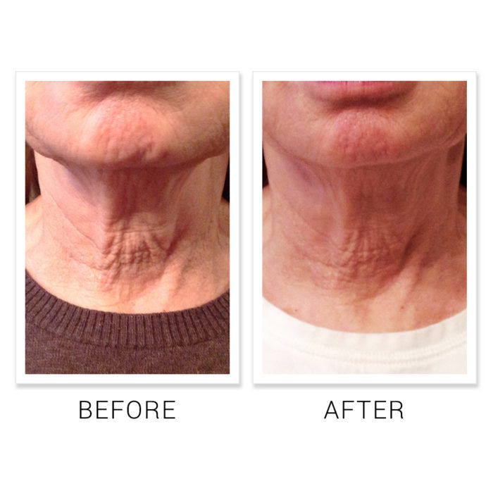 Thumbnail: Neck & Décolleté Peptide Cream