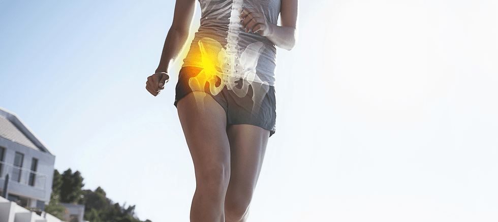 Runner running with hip replacement. One of the services offered by Jonathan Quayle