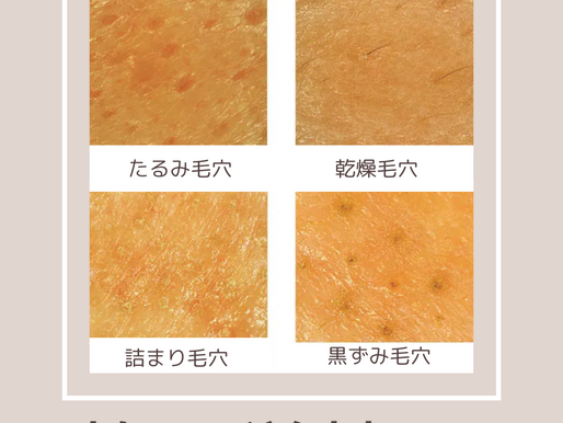 毛穴放置していませんか?