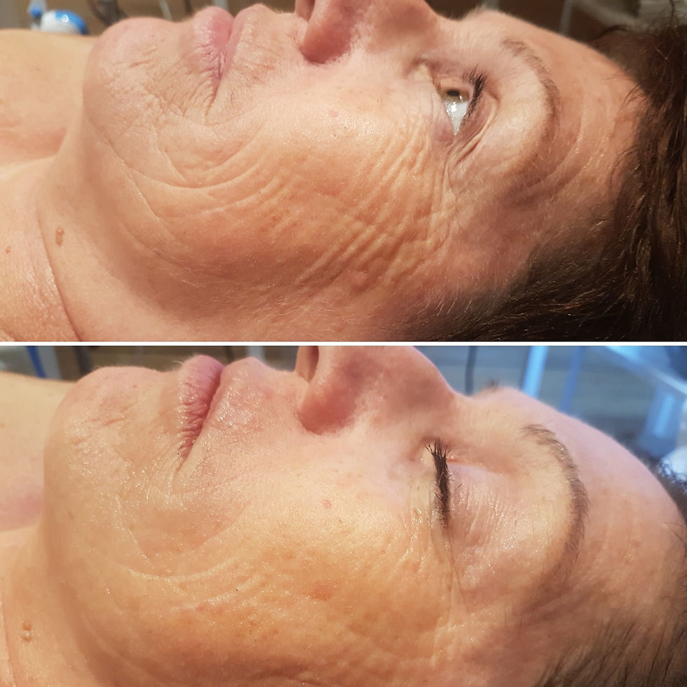 Avant/Après 2 soins biocompatibles!