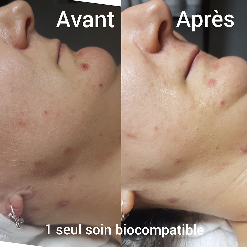 Avant/Apres 1 soin Biocompatible