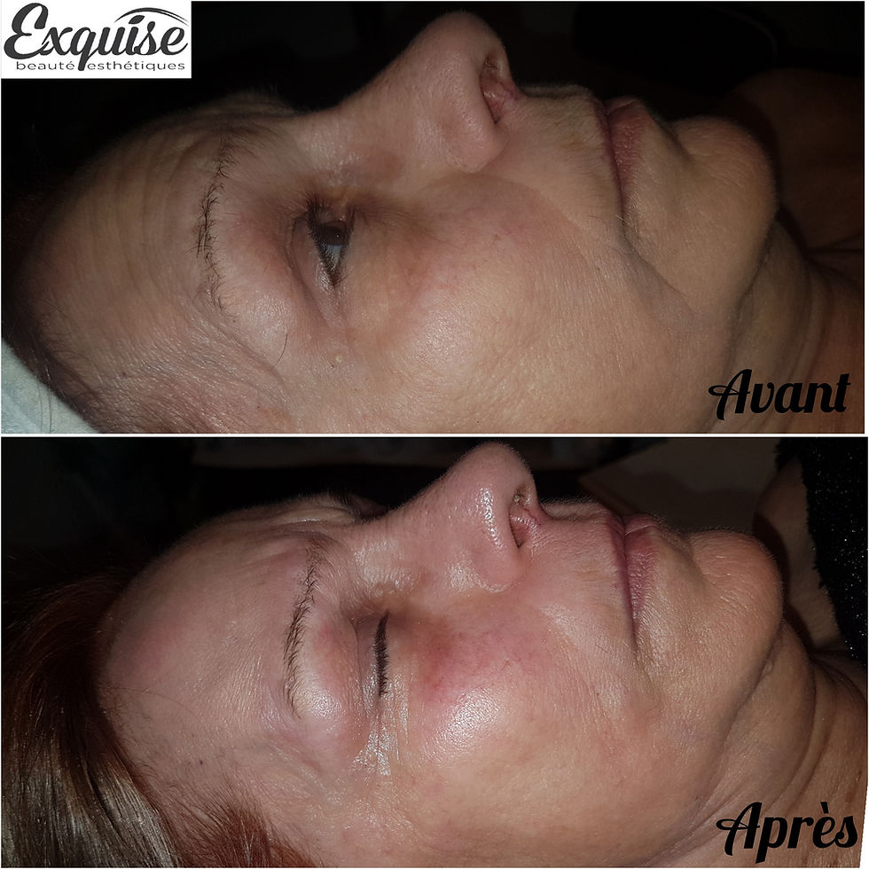 1 soin biocompatible