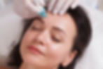 Hydra-Facial - Hydradermabrasion with Radio Frequency