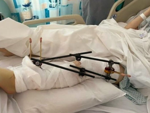 Ekskluzivno; Sladjana Petrušić, kako je drugi Tik Tok izazov pošao po zlu?!