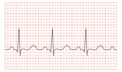 ECG Training - 1/2 Day