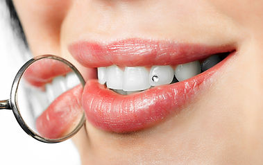 tooth-jewellery.jpg