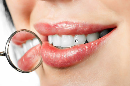 tooth-jewellery.jpg