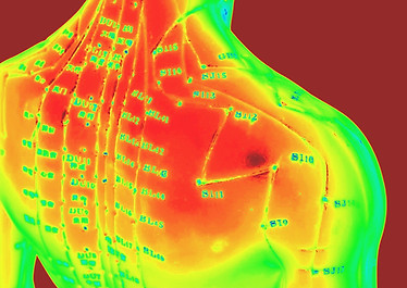 The Eastern or Asian acupuncture medical treatment said to prevent or treat a variety of m