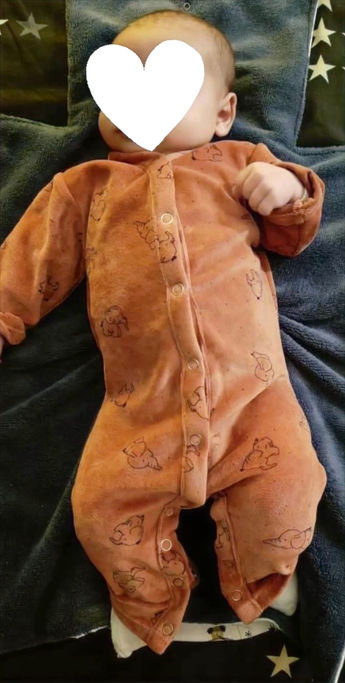 PYJAMA BEBE COLOSTOMIE