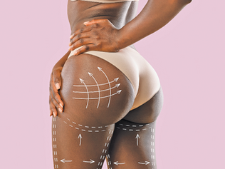 Black woman BBL