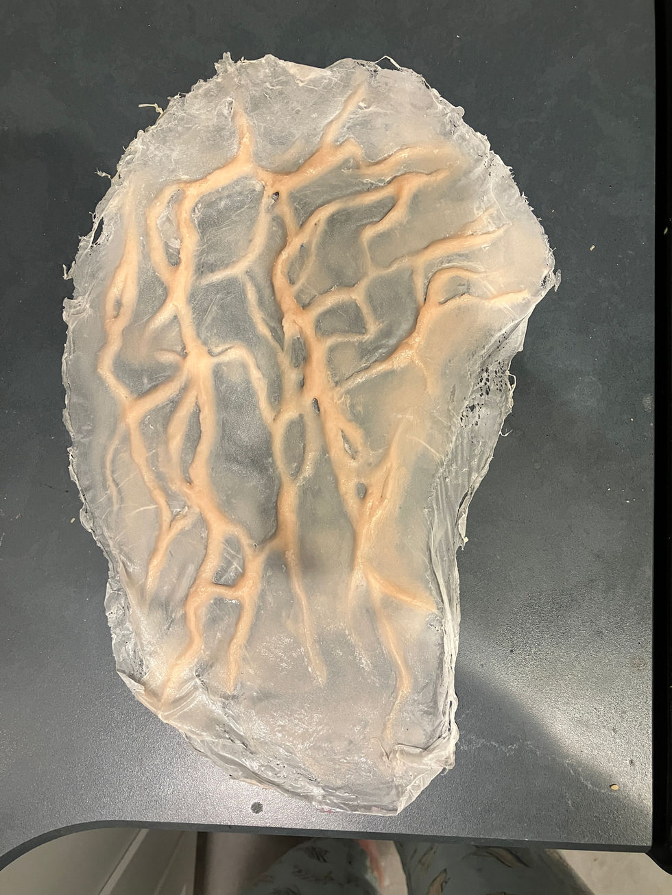 First encapsulated silicone prosthetic piece for arm