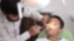 dental sealants